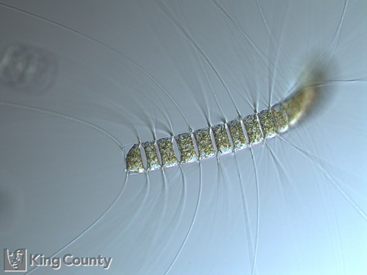 Photo of Chaetoceros eibenii